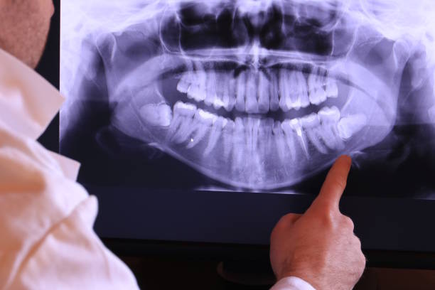 Best Pediatric Emergency Dentist in Rantoul, IL