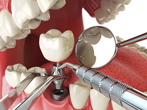 Best Orthodontic Emergency Dentist in Rantoul, IL